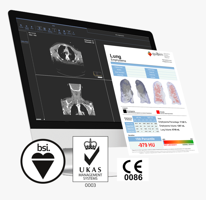 Quibim Ce Mark - Ukas Quality Management, HD Png Download