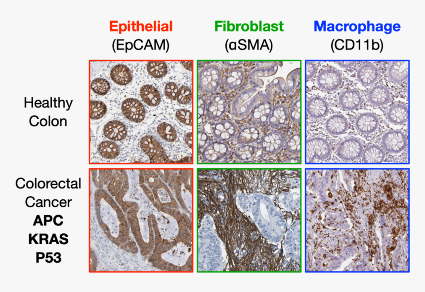 Research Fig 1 - Igneous Rock, HD Png Download
