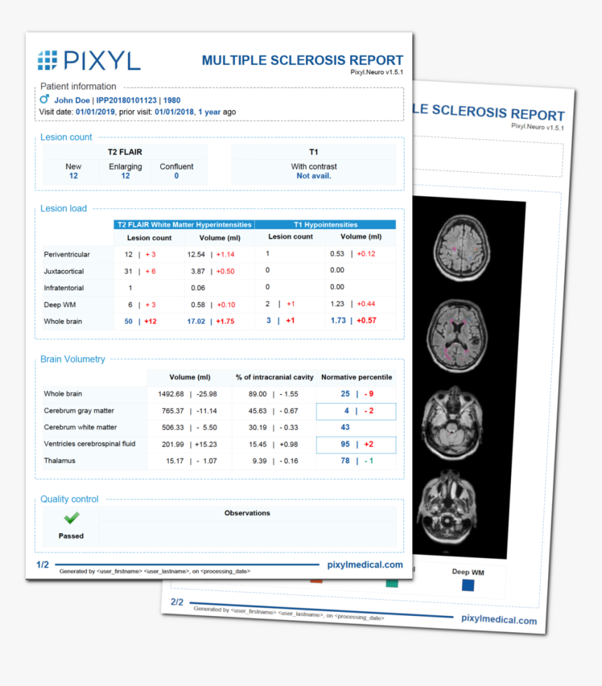 Reports Of Multiple Sclerosis, HD Png Download