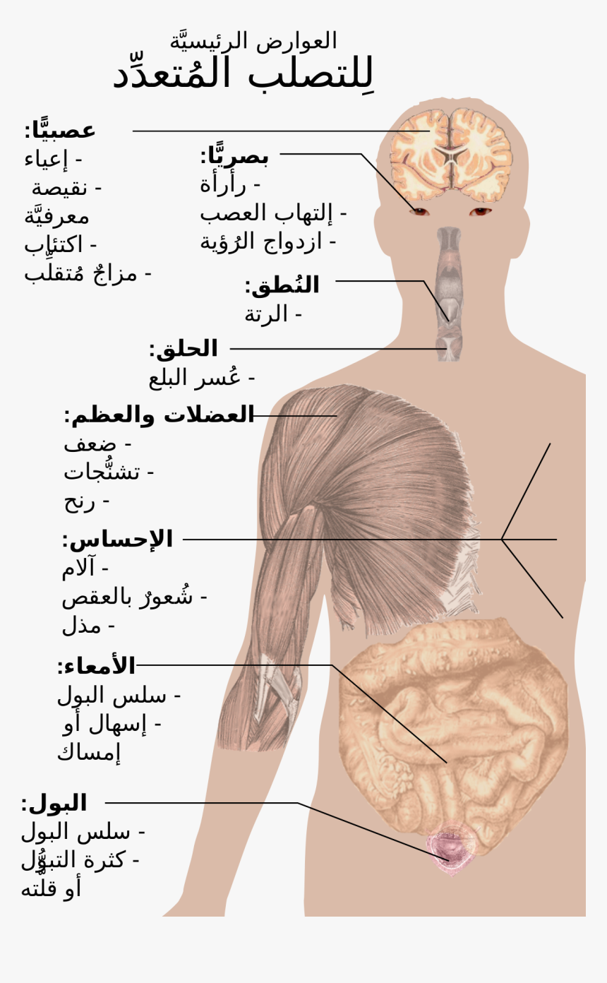 Do People Get Ms, HD Png Download