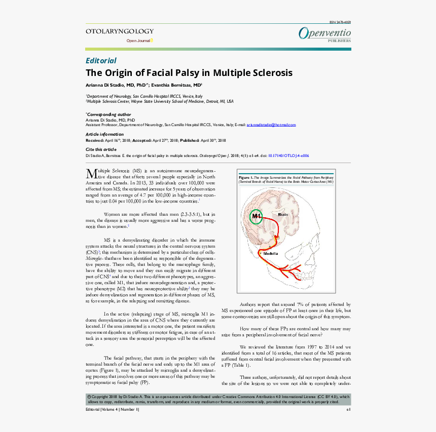 Multiple Sclerosis Facial Palsy, HD Png Download