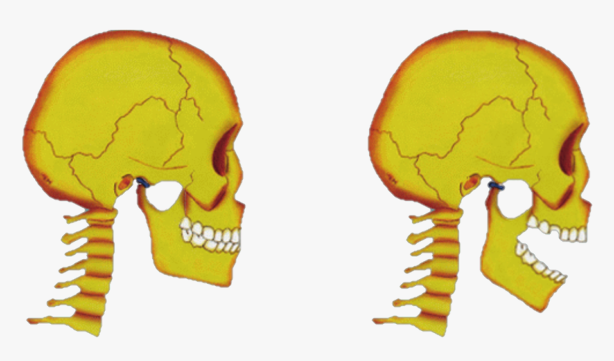 Tmj Disorders Jaw Joint Pain - Skull, HD Png Download