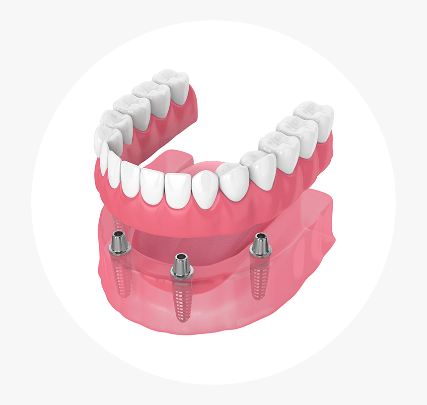Dentures, HD Png Download