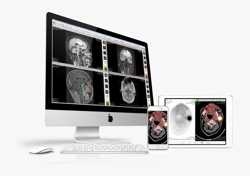 Computed Tomography, HD Png Download