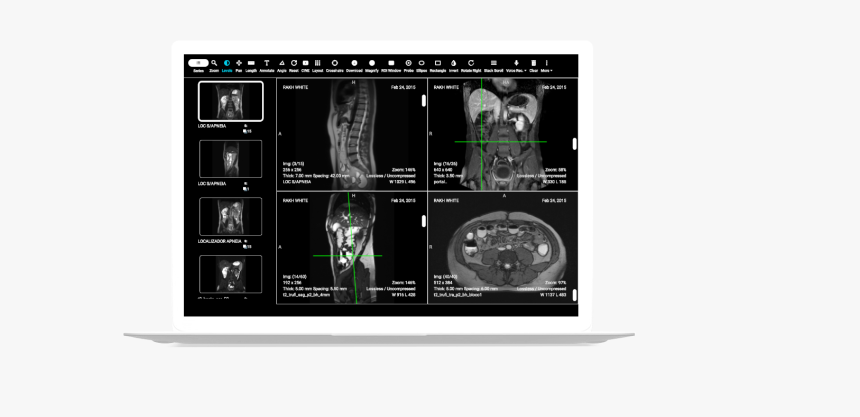 Computed Tomography, HD Png Download