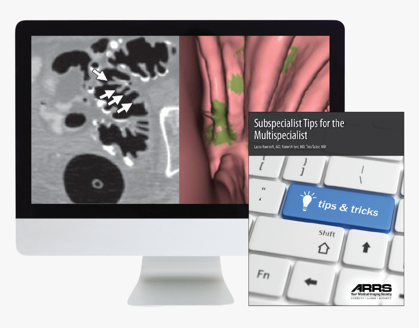 Computer Monitor, HD Png Download