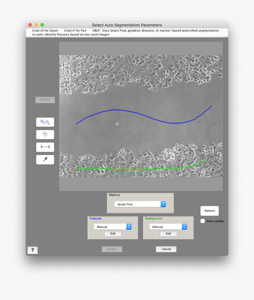 Fast Marching Methods Image Segmentation, HD Png Download