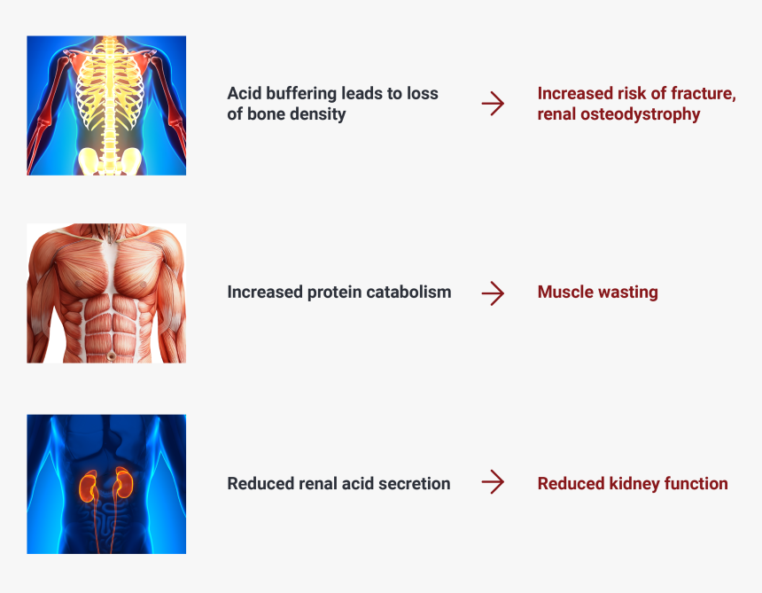 Image Depicting Serious Consequences Of Chronic Metabolic - Art, HD Png Download