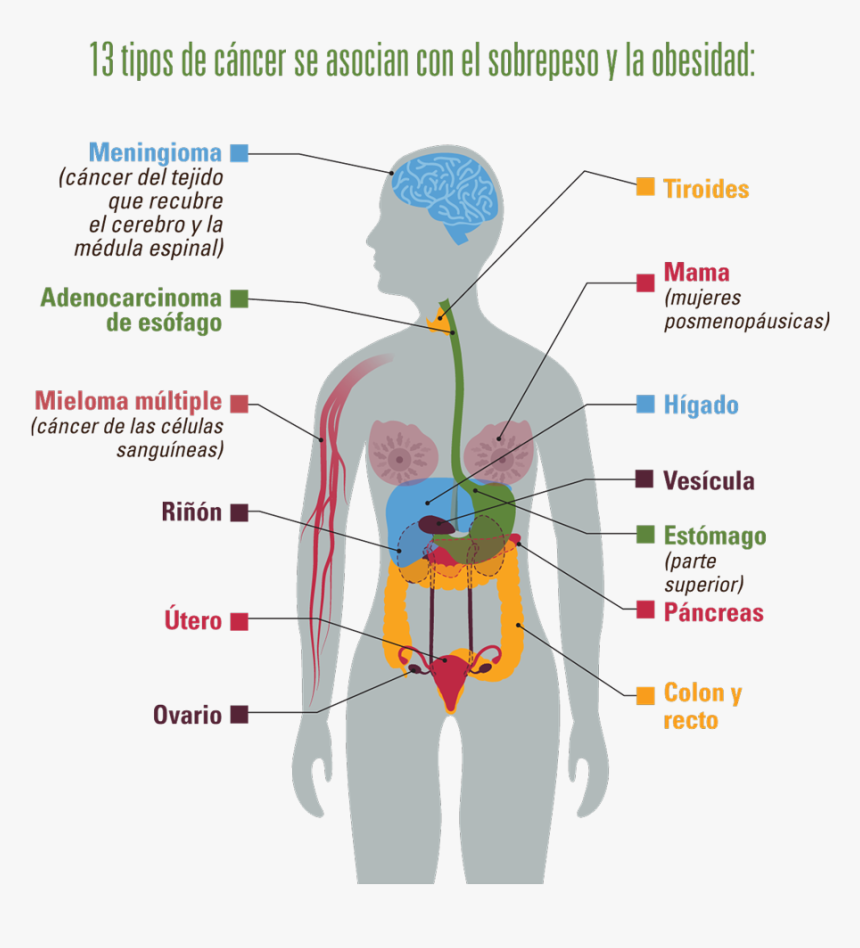 13 Tipos De Cáncer Se Asocian Con El Sobrepeso Y La - Diversos Tumores Y Cánceres Del Sistema Circulatorio, HD Png Download