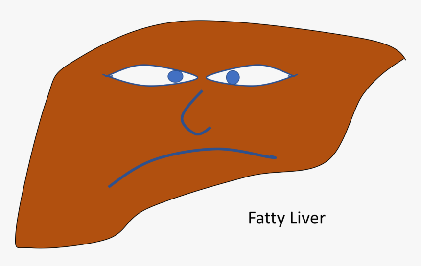 Non-alcoholic Fatty Liver Disease Clipart , Png Download, Transparent Png