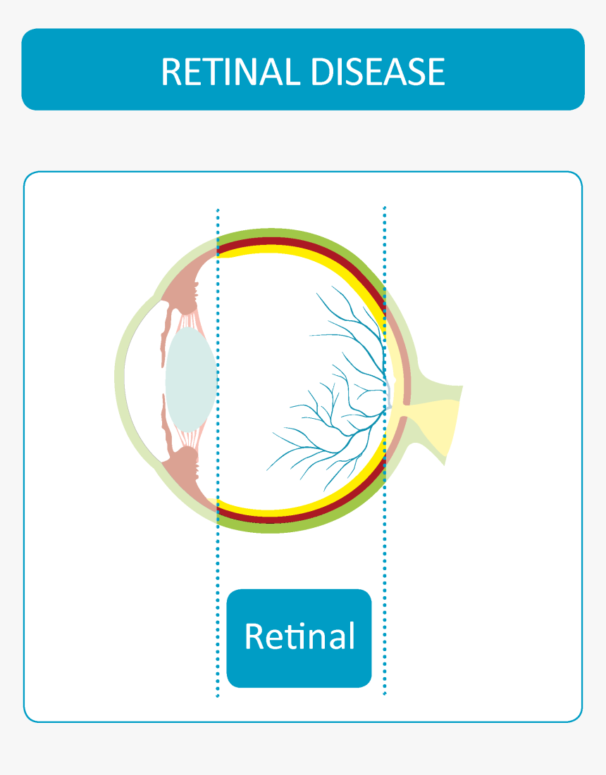 Retinal Diseases - Circle, HD Png Download
