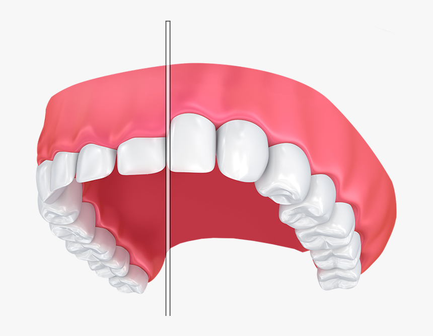 Transparent Teeth Smile Png - Gums, Png Download