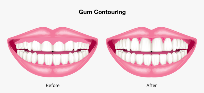 Contoured Teeth, HD Png Download