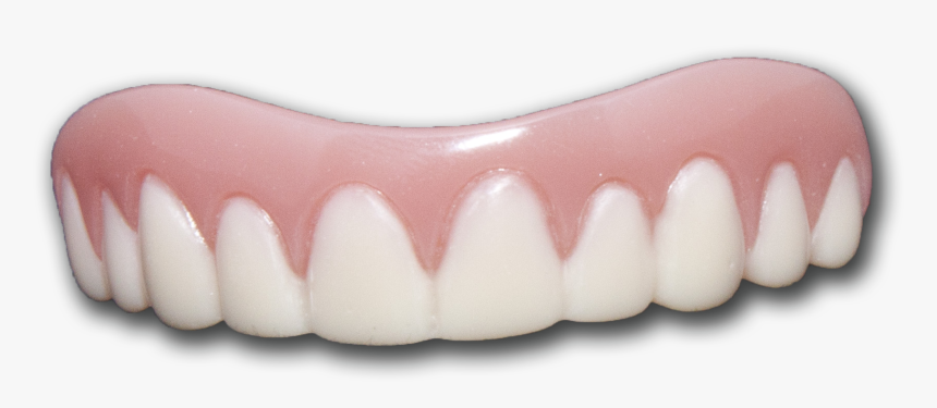 Tooth Bleaching, HD Png Download