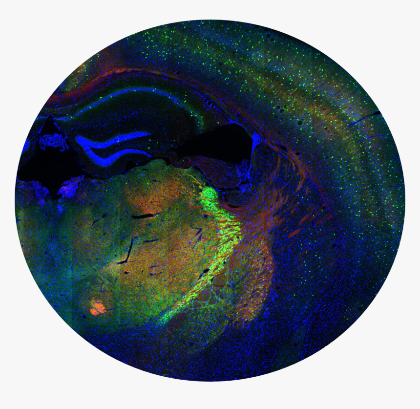 Clip Art Picture Of The Brain - Brain Ihc, HD Png Download