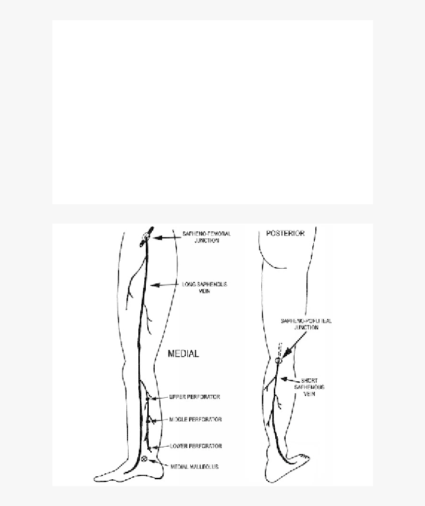 Black Veins Png, Transparent Png