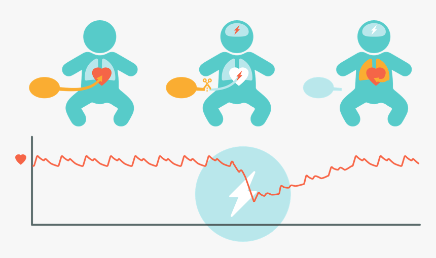 Asphyxia In Neonates Clipart, HD Png Download