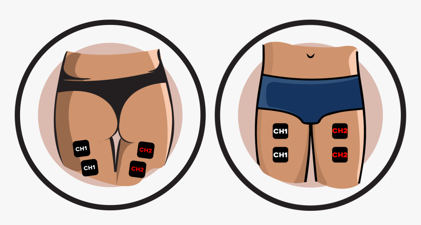 Thigh Electrode Pad Placement Clipart , Png Download - Pad Placement For Sciatica, Transparent Png