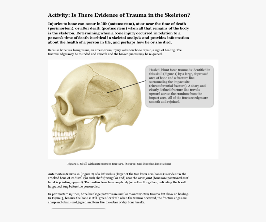 Skull, HD Png Download