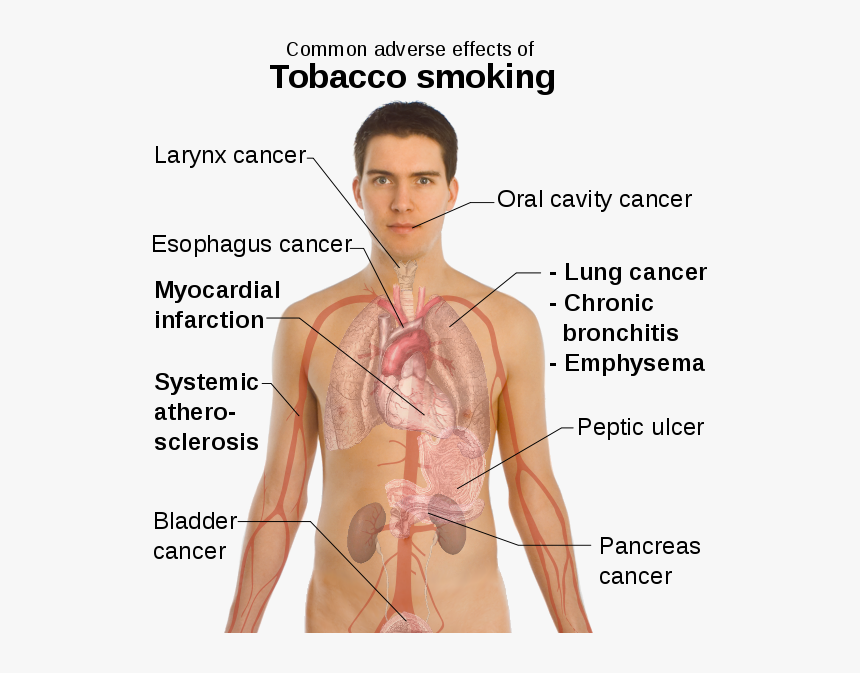 [​img] - Diseases In Circulatory System Caused By Smoking, HD Png Download