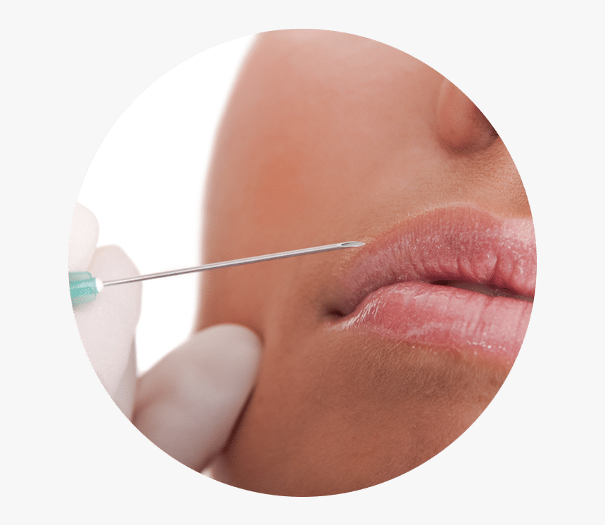 Pink Lips Injection , Png Download - Injection, Transparent Png