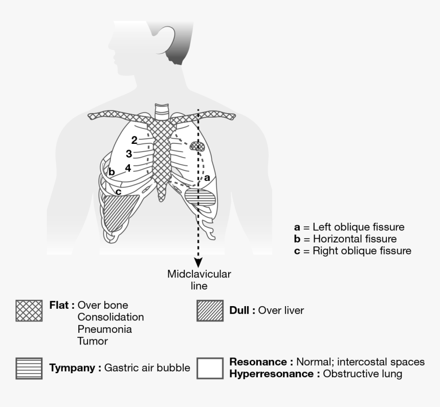 Twitch Kappa Png, Transparent Png