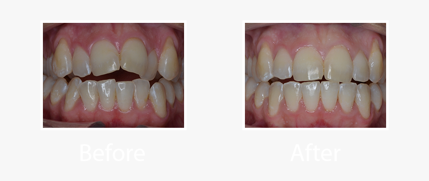 Macro Photography, HD Png Download