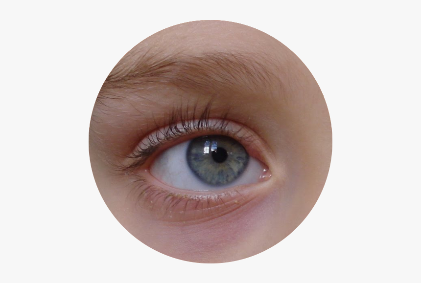 Κοκκινιλεσ Κατω Απο Τα Ματια Σε Παιδια, HD Png Download