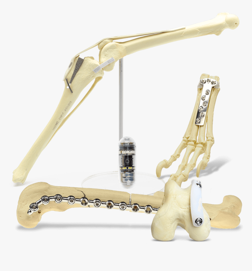 All Categories Mmo, Sop, Ridgestop, Carpal Arthrodesis, - Figurine, HD Png Download