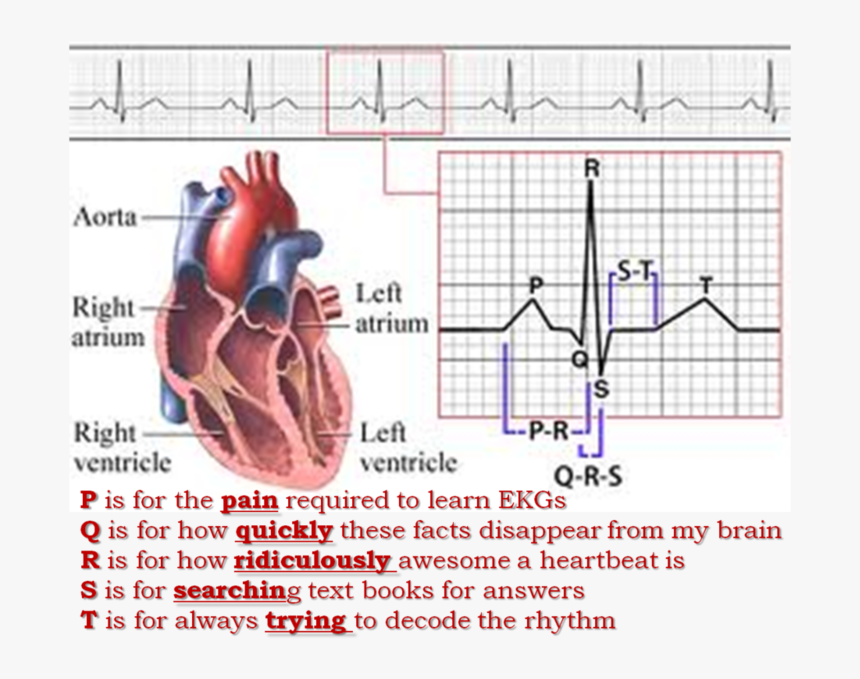 24hr Holter Monitor - Fenomeno Electrico Del Corazon, HD Png Download