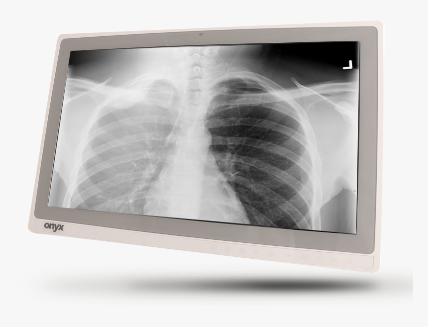 X-ray, HD Png Download