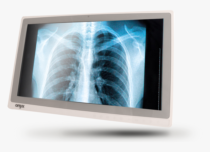 Onyx Zeus, HD Png Download