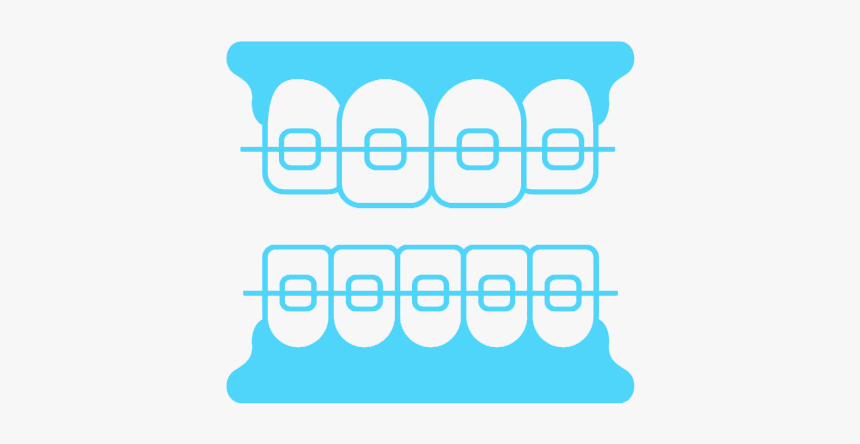 Burns Orthodontics Clear Braces For Straight Teeth - Graphics, HD Png Download