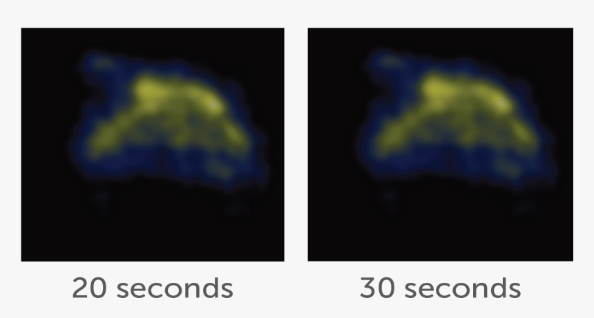 Clinical Fig2 - Visual Arts, HD Png Download