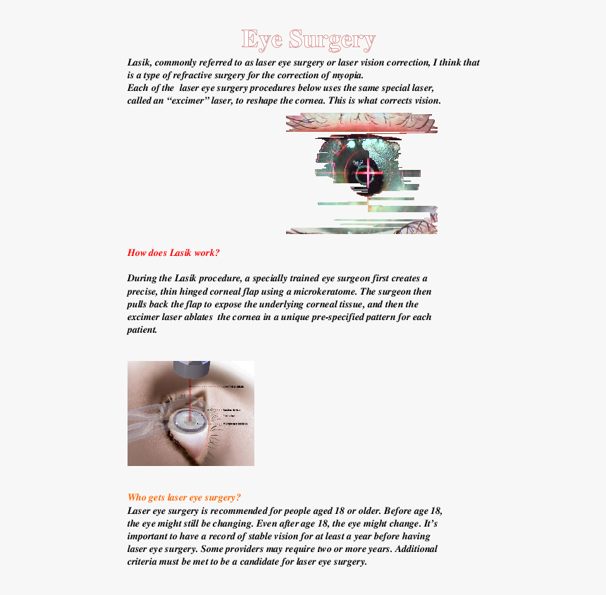 Laser Eye Surgery, HD Png Download