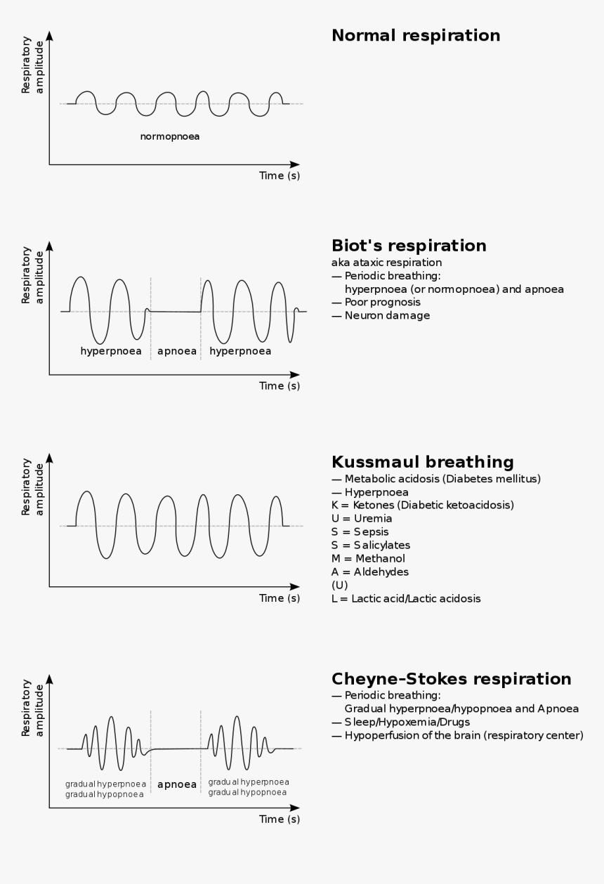 Kussmaul Breathing, HD Png Download