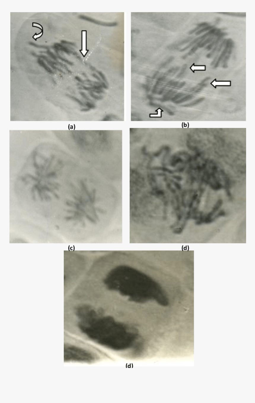 Abnormal Anaphase Cells Showing - Medical Imaging, HD Png Download