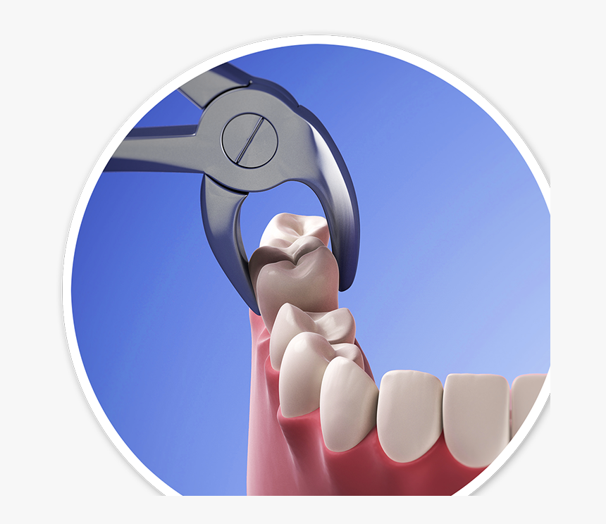 Horizon Microscope Enhanced Dentistry - Tooth Extraction Data, HD Png Download