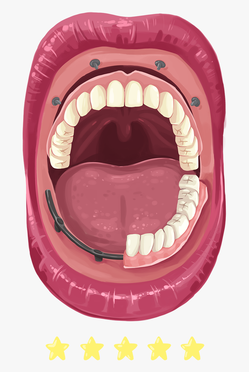 Missing Tooth, HD Png Download