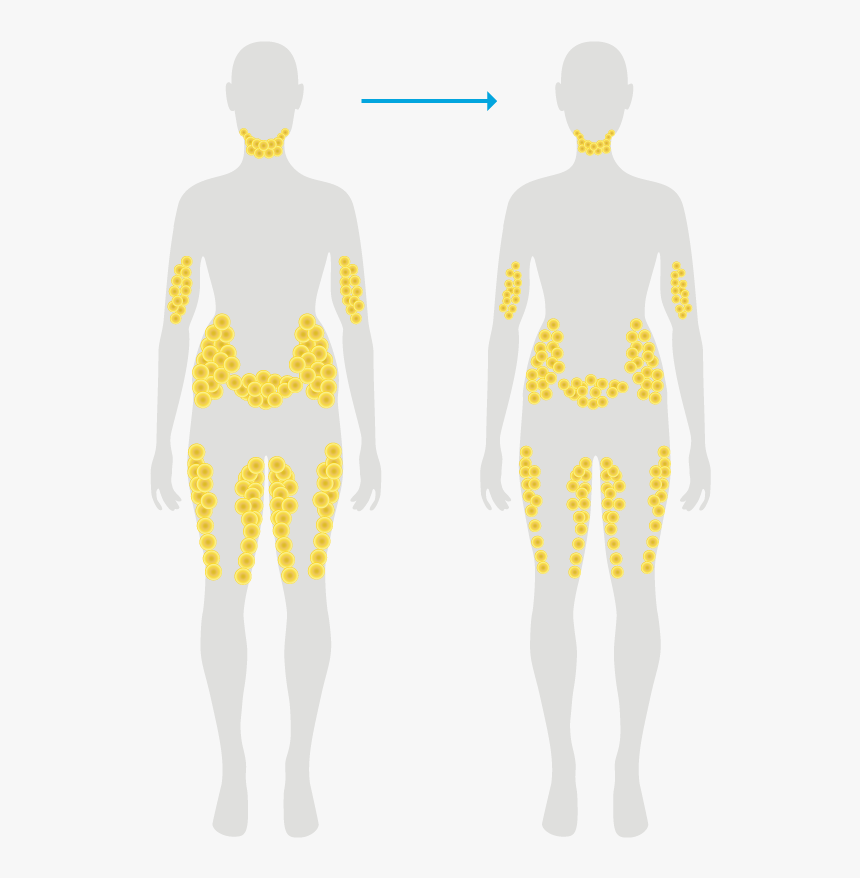 Fat Cells After Typical Weight Loss - Fat Cell Location On Body, HD Png Download