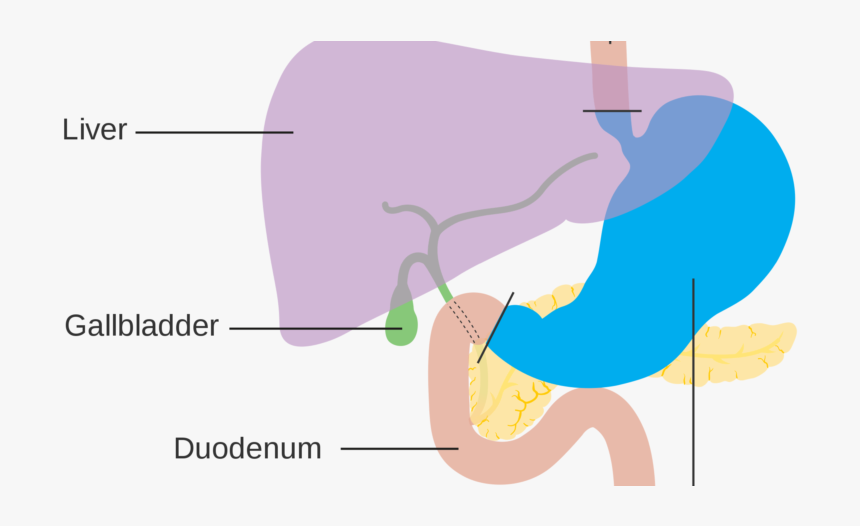 Facts About Stomach Cancer - Graphic Design, HD Png Download