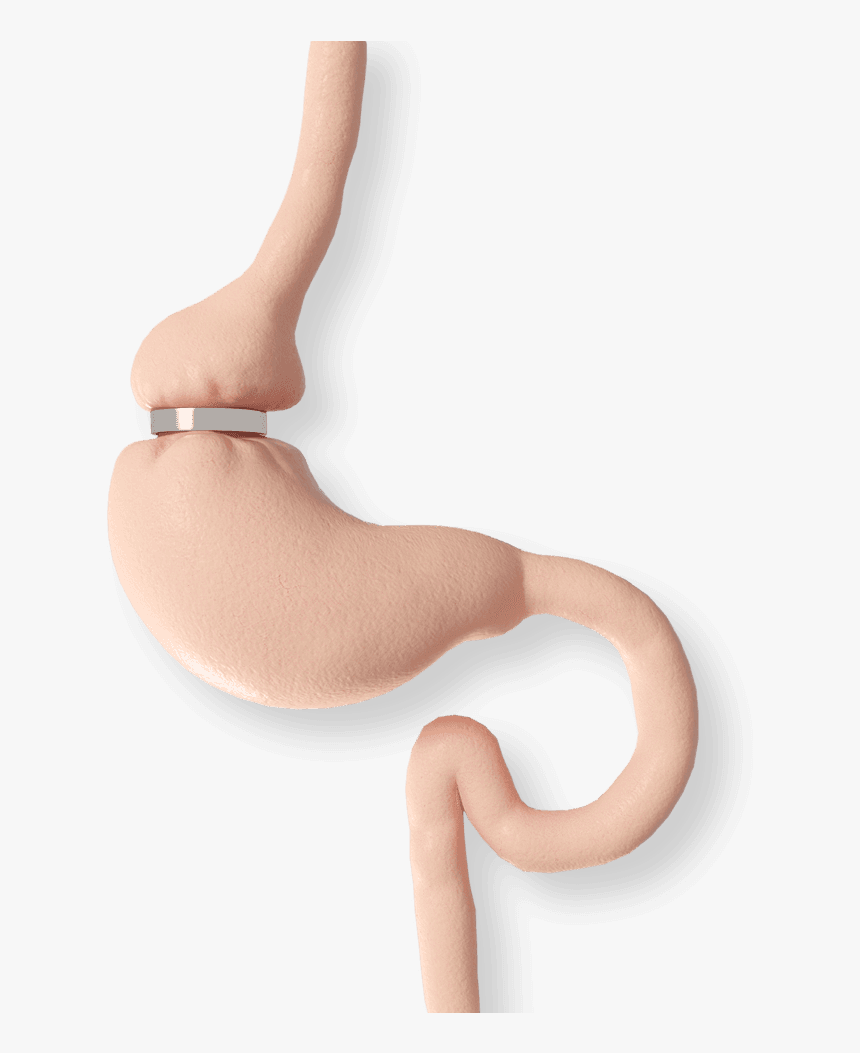 Stomach With A Lap Band - Chair, HD Png Download