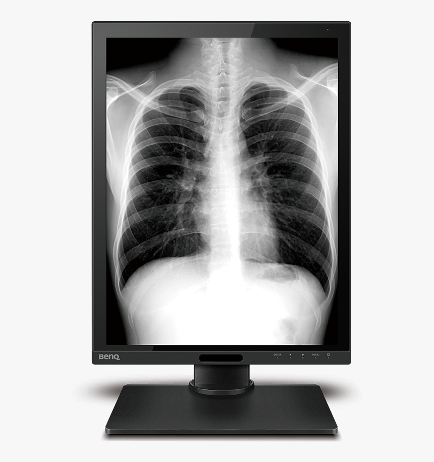 X-ray, HD Png Download