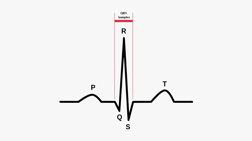 Normal Sinus Rhythm, HD Png Download