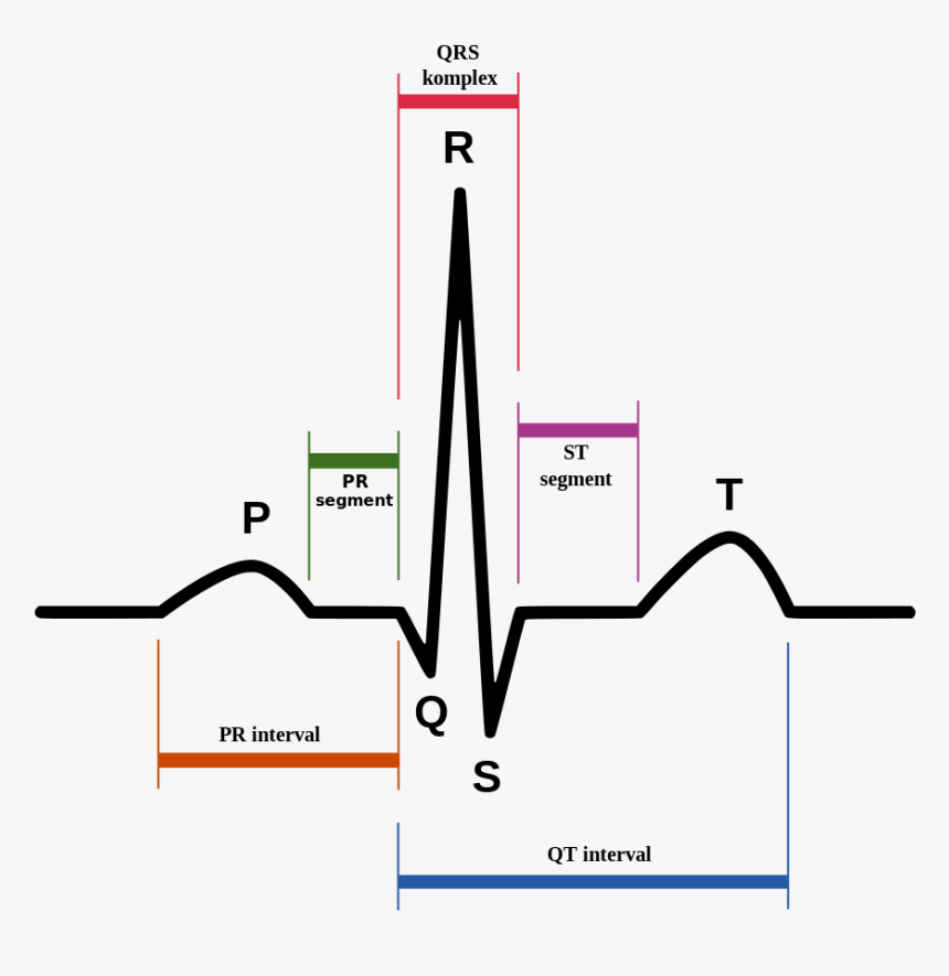 Normal Sinus Rhythm, HD Png Download