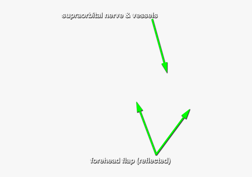 Diagram, HD Png Download