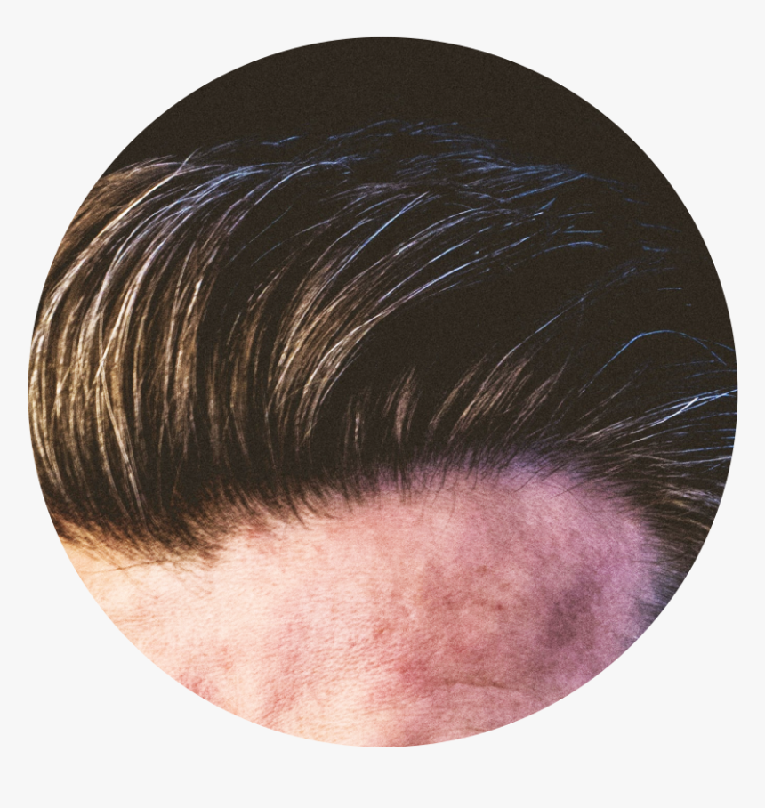 Lace Wig, HD Png Download