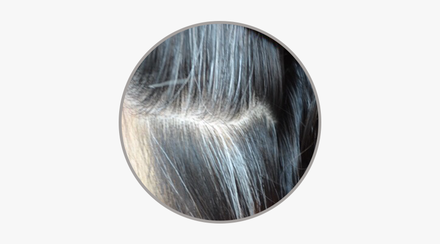 年轻 白 头发, HD Png Download