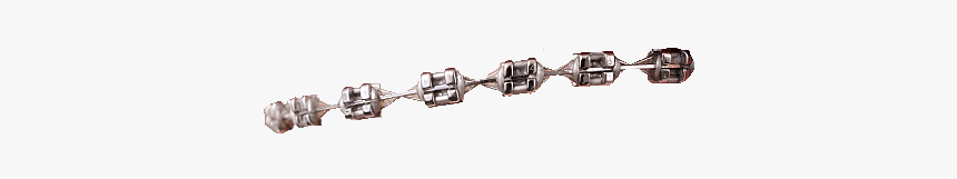 #braces #bracesmile #teeth #tooth #metal #steel #wire - Body Jewelry, HD Png Download