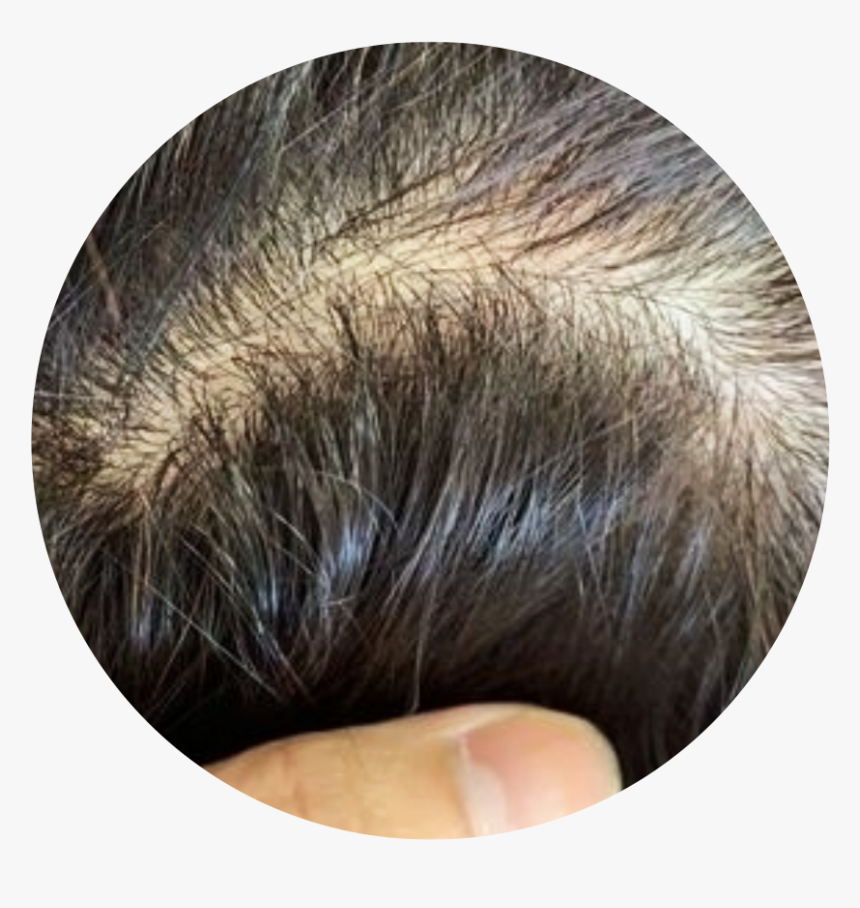 Lace Wig, HD Png Download